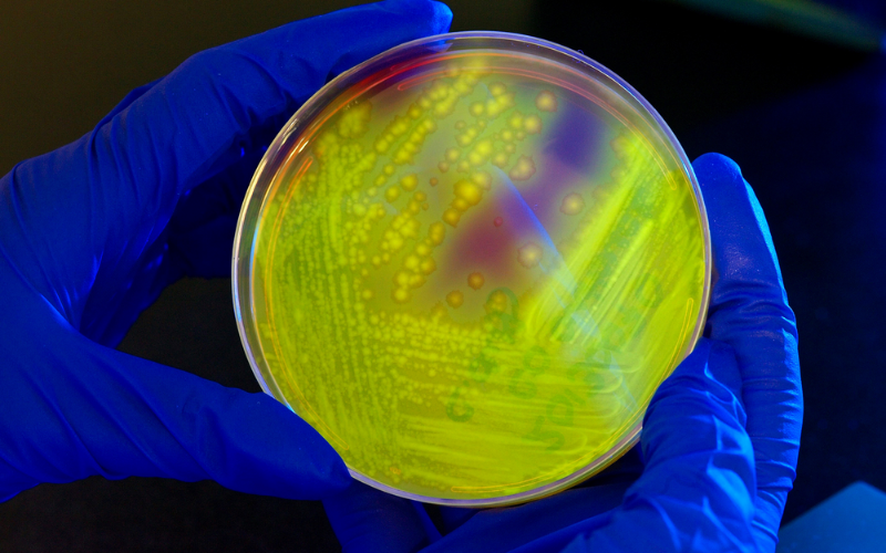 公定法 vs 標準法：細菌検査で何が違うのか